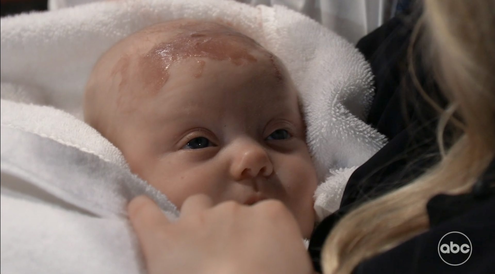 General Hospital